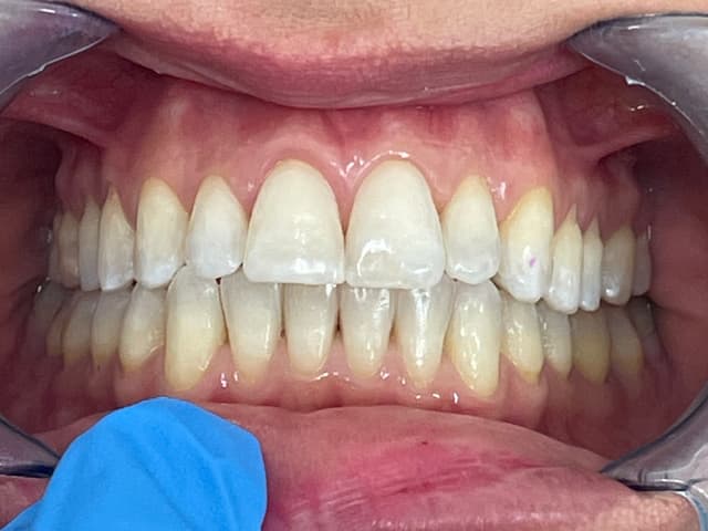Image before and after treatment