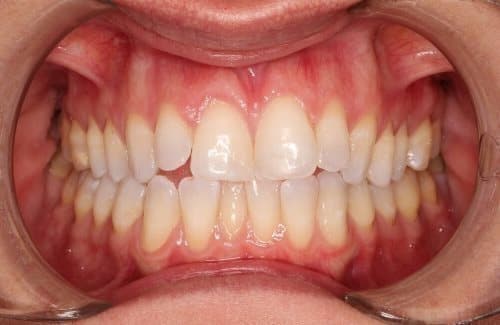 Image before and after treatment