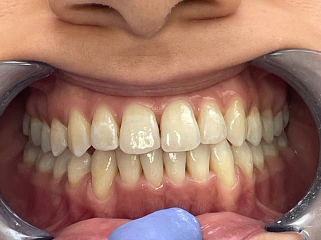 Image before and after treatment