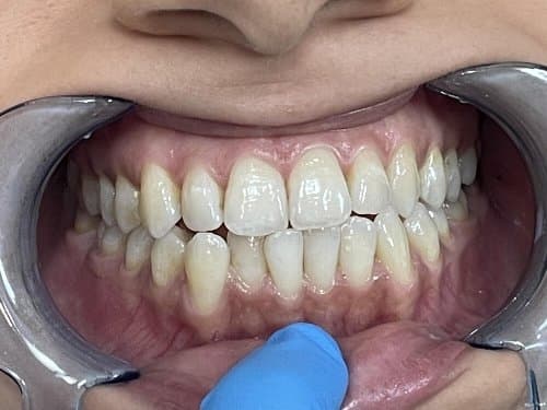 Image before and after treatment