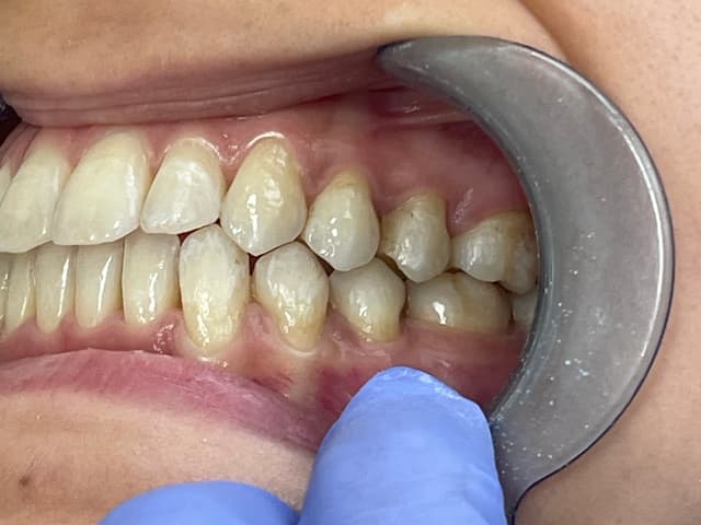 Image before and after treatment