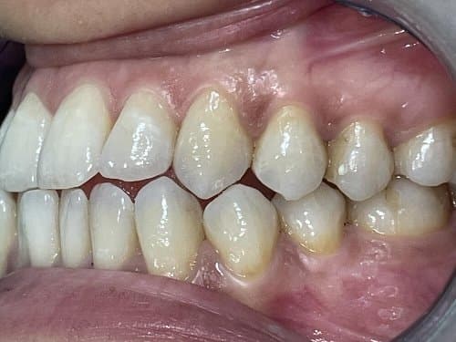Image before and after treatment