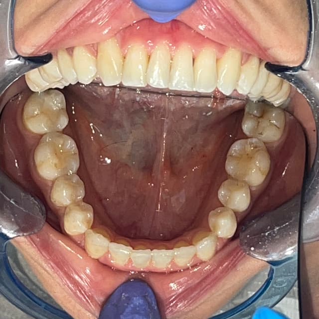 Image before and after treatment