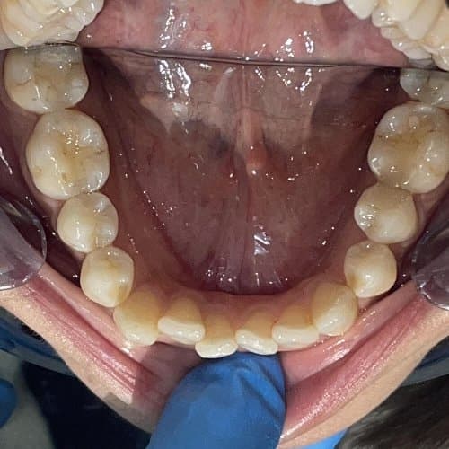 Image before and after treatment