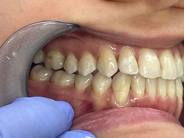 Image before and after treatment