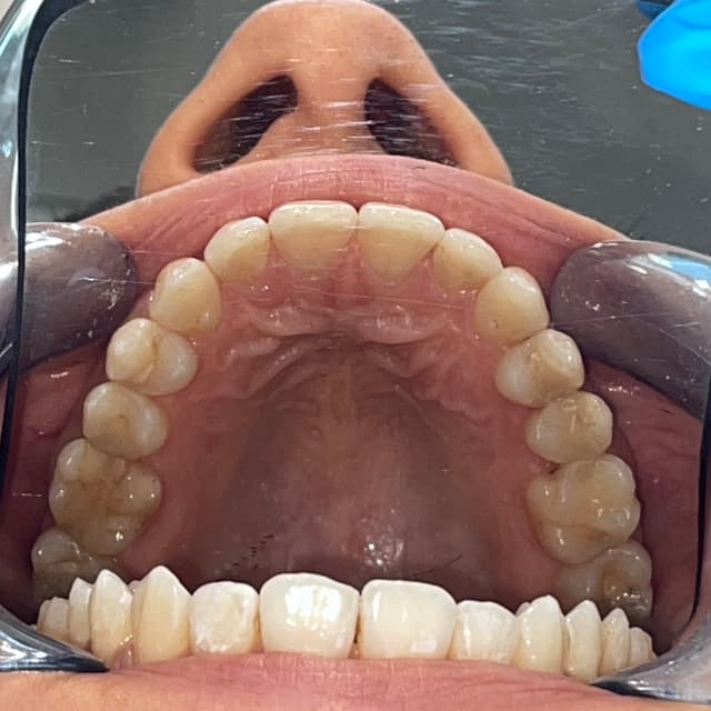 Image before and after treatment