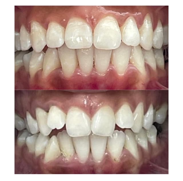 Image before and after treatment