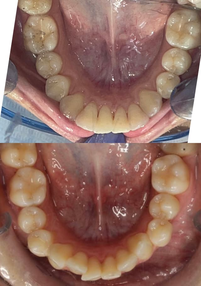 Image before and after treatment