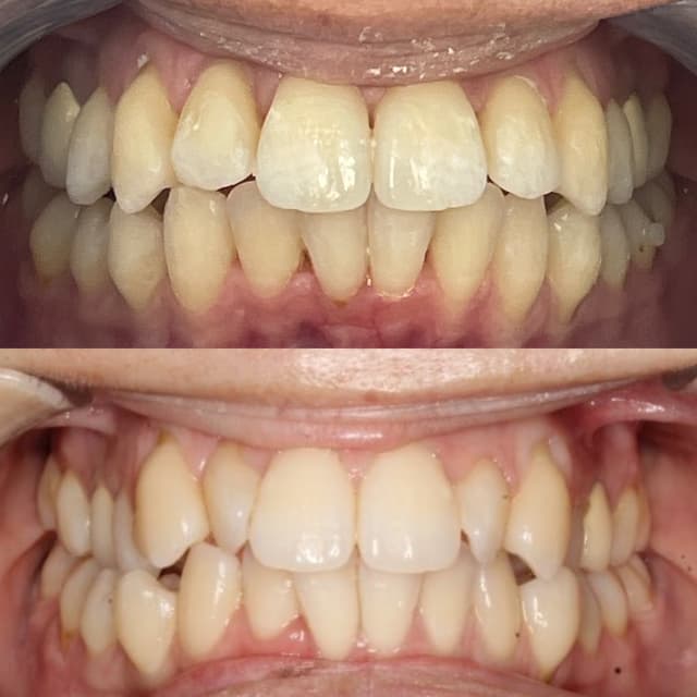 Image before and after treatment