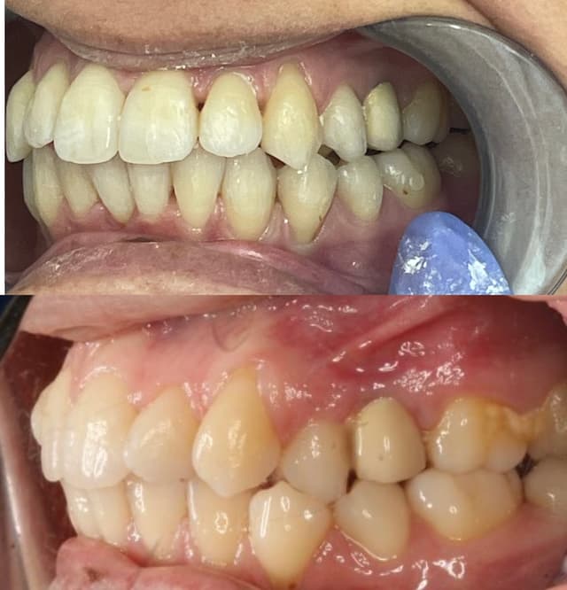 Image before and after treatment