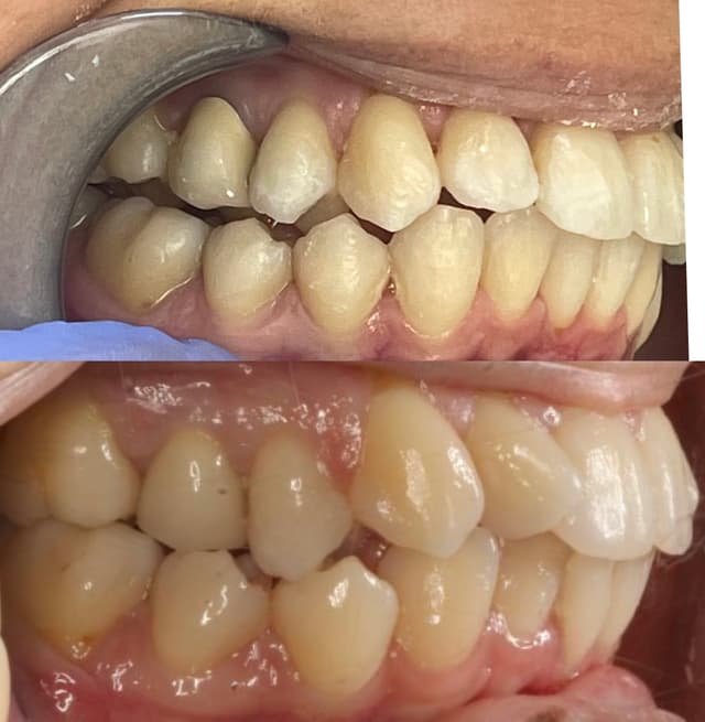 Image before and after treatment