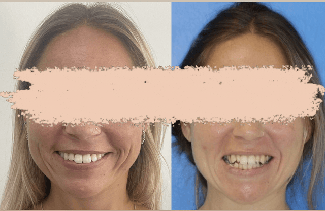 Image before and after treatment