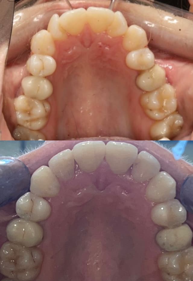 Image before and after treatment