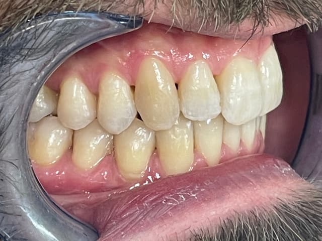 Image before and after treatment