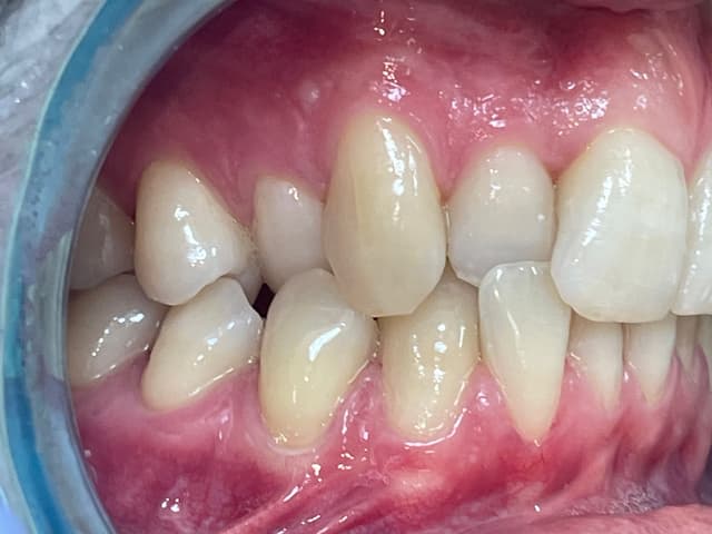 Image before and after treatment