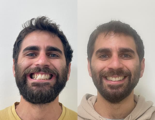 Image before and after treatment
