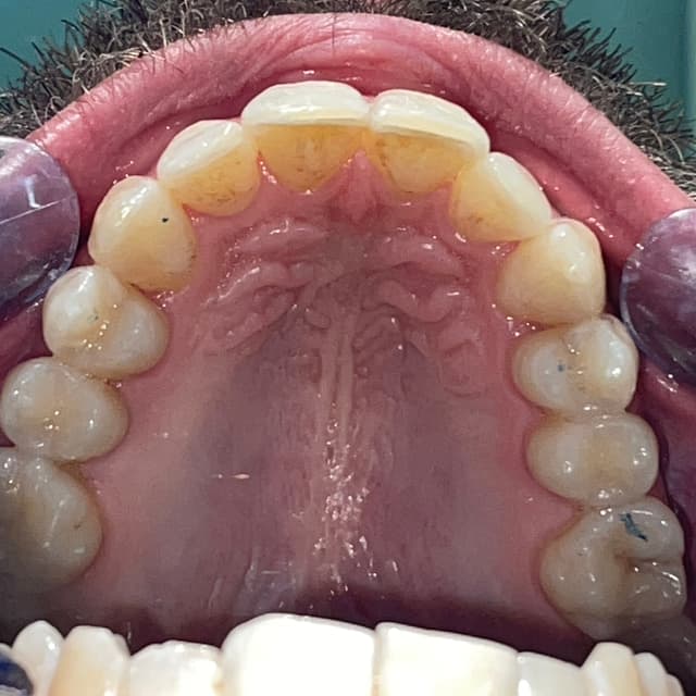 Image before and after treatment