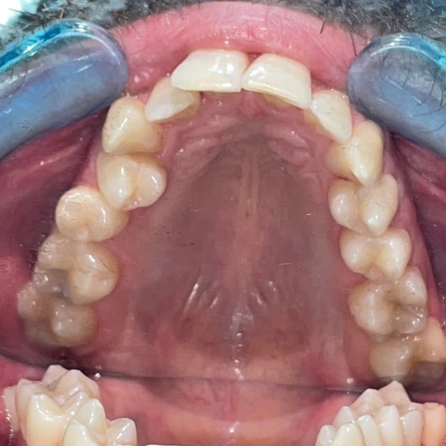Image before and after treatment