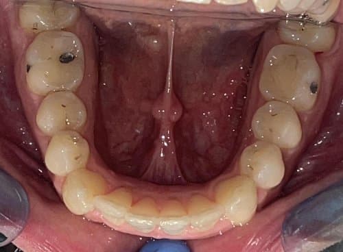 Image before and after treatment